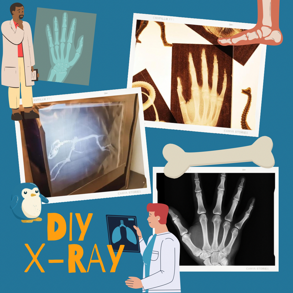 How are X-Ray images Shown?